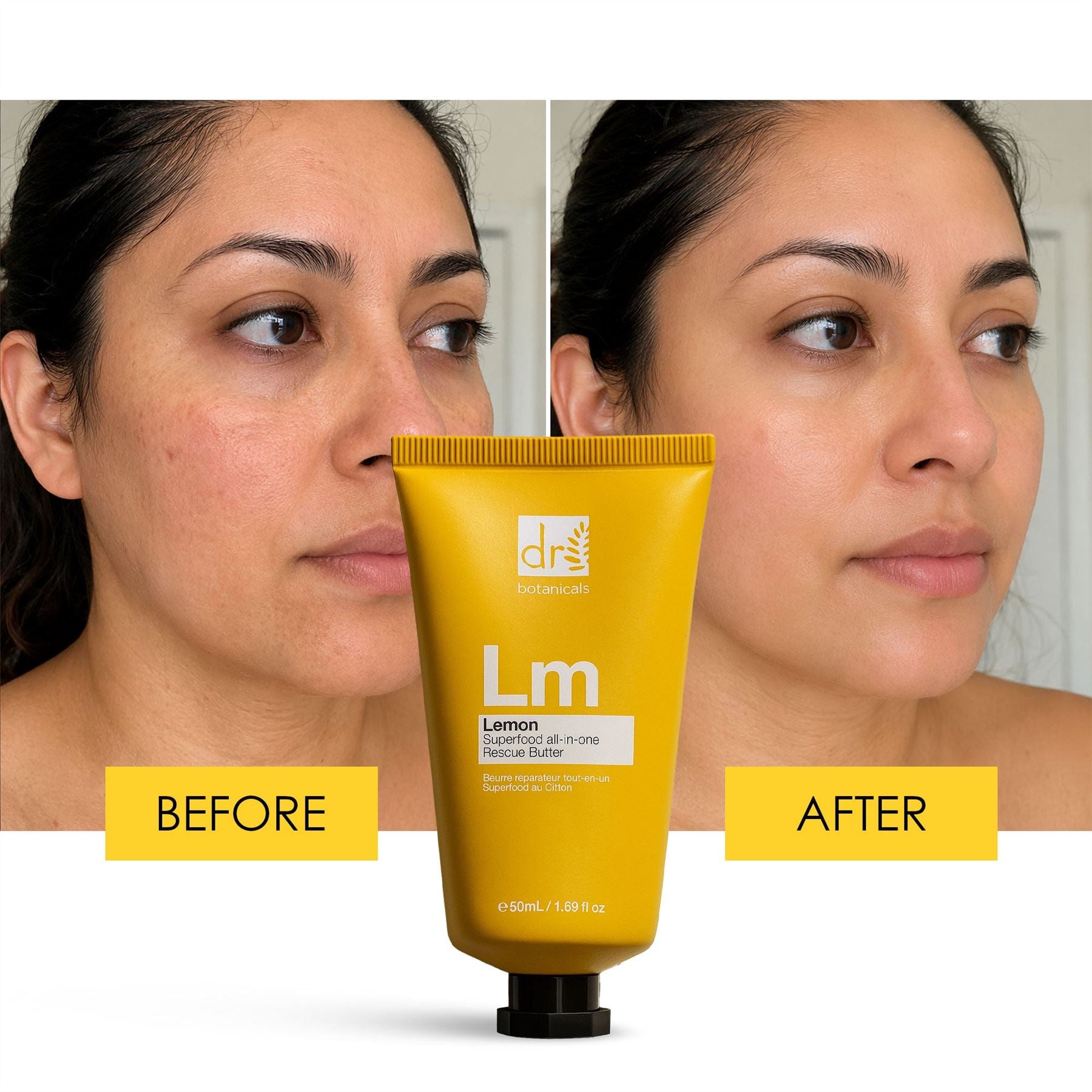 RDB Lemon Superfood all-in-one Rescue Butter 50ml Trio Set