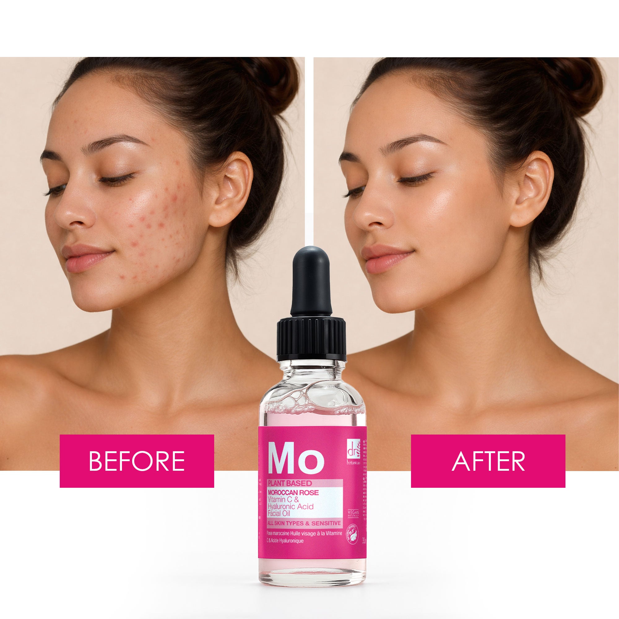 Huile pour le visage à la rose marocaine avec acide hyaluronique et vitamine C